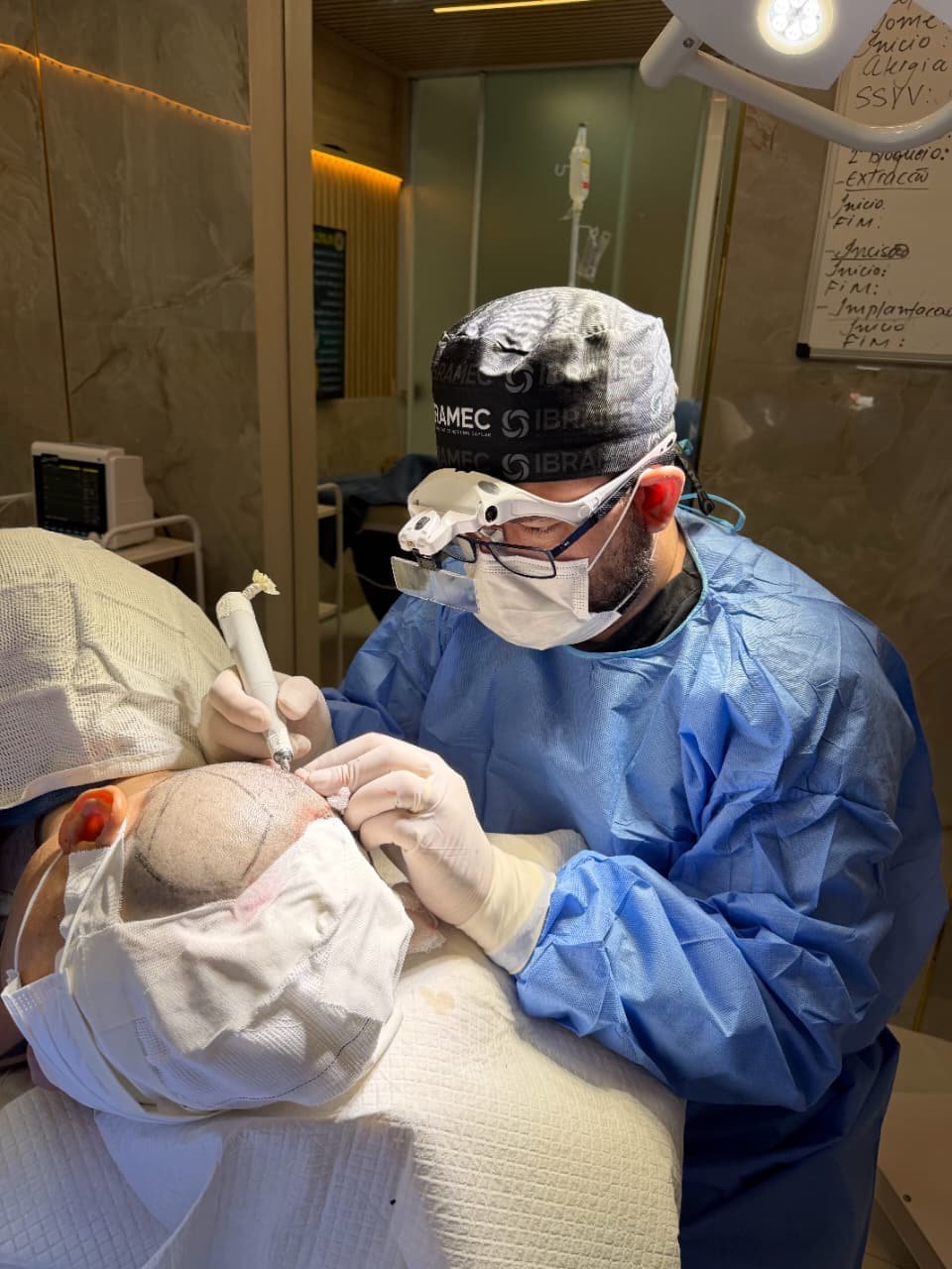 Finalização do procedimento de transplante capilar FUE